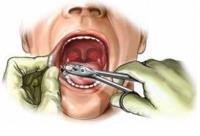 Dentist in Ferntree Gully - Dentistree image 2